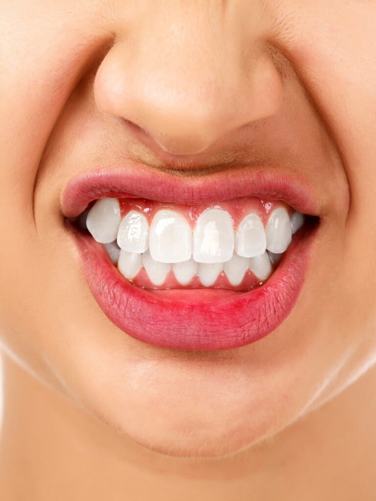 Choroba okluzyjna zębów – co warto o niej wiedzieć?